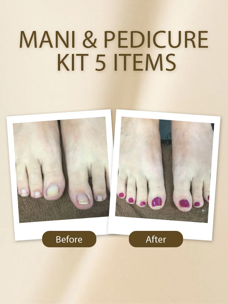 Mani & Pedicure Kit 5 Items - Image 5