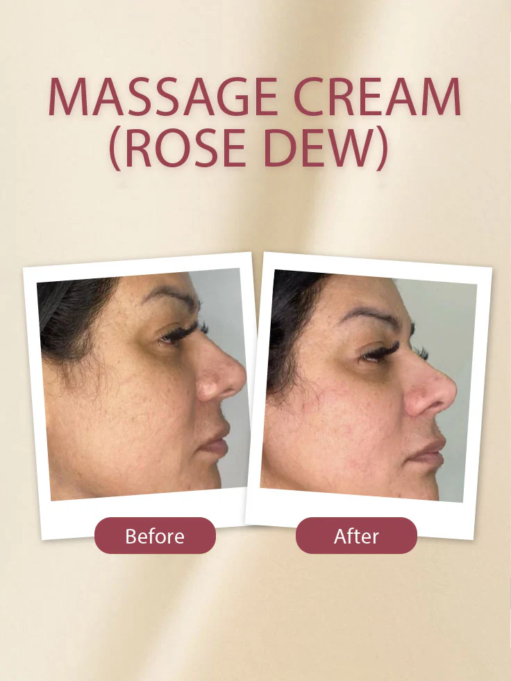 Massage Cream (Rose Dew) - Image 5