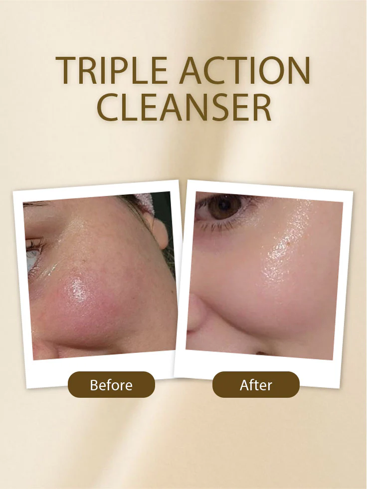 Triple Action Cleanser - Image 4